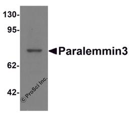 Western blot analysis of Paralemmin3 in MCF7 cell lysate with Paralemmin3 antibody at 1 μg/mL.
