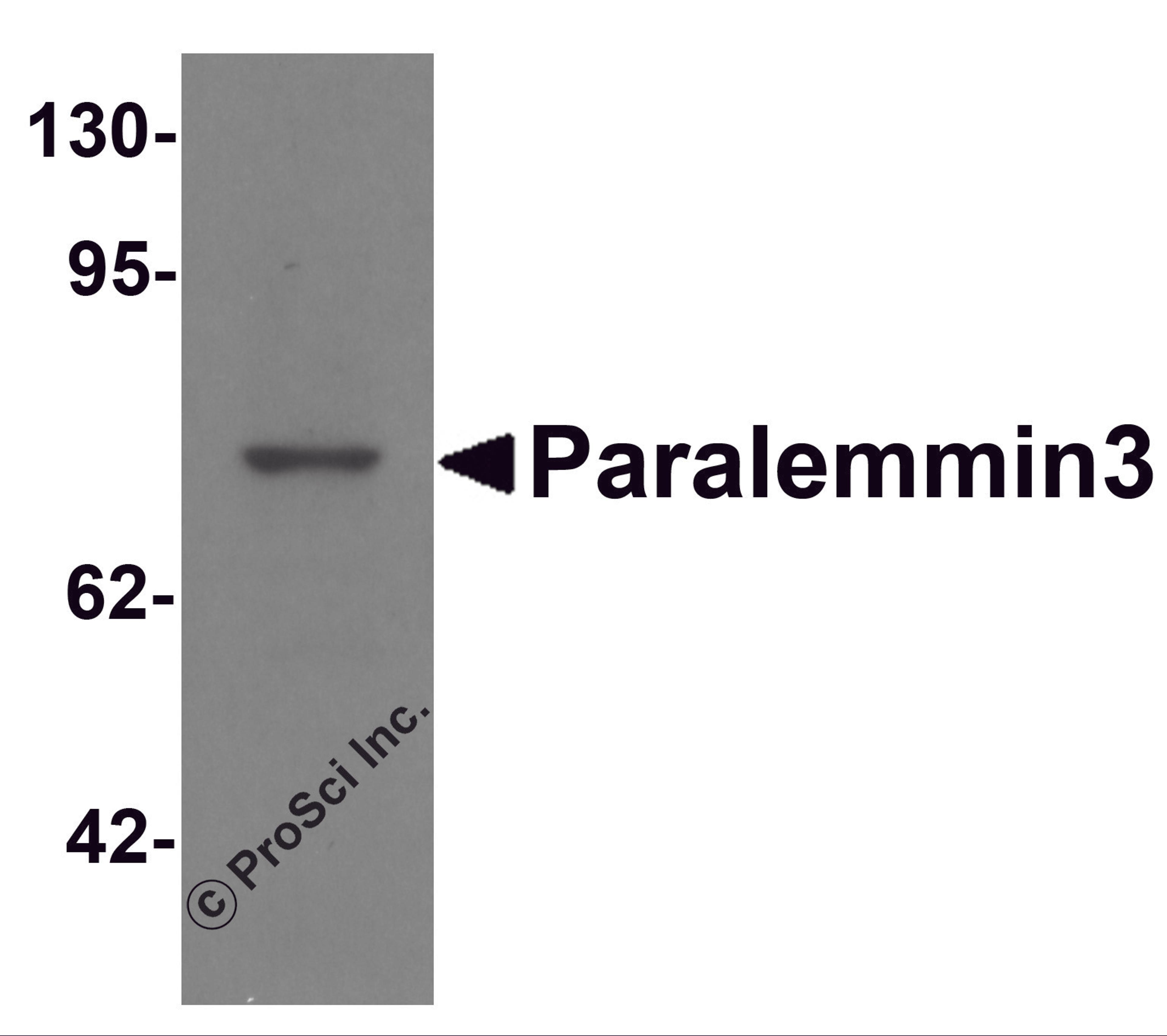 Western blot analysis of Paralemmin3 in MCF7 cell lysate with Paralemmin3 antibody at 1 μg/mL.