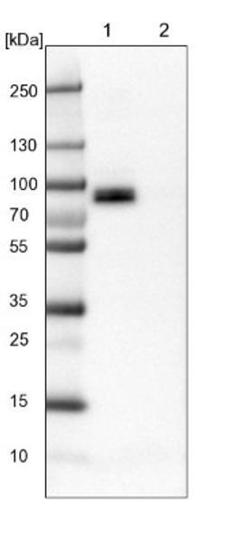 Western Blot: Glycogen synthase 2 Antibody [NBP1-91191] - Lane 1: Mouse liver tissue lysate<br/>Lane 2: Rat liver tissue lysate