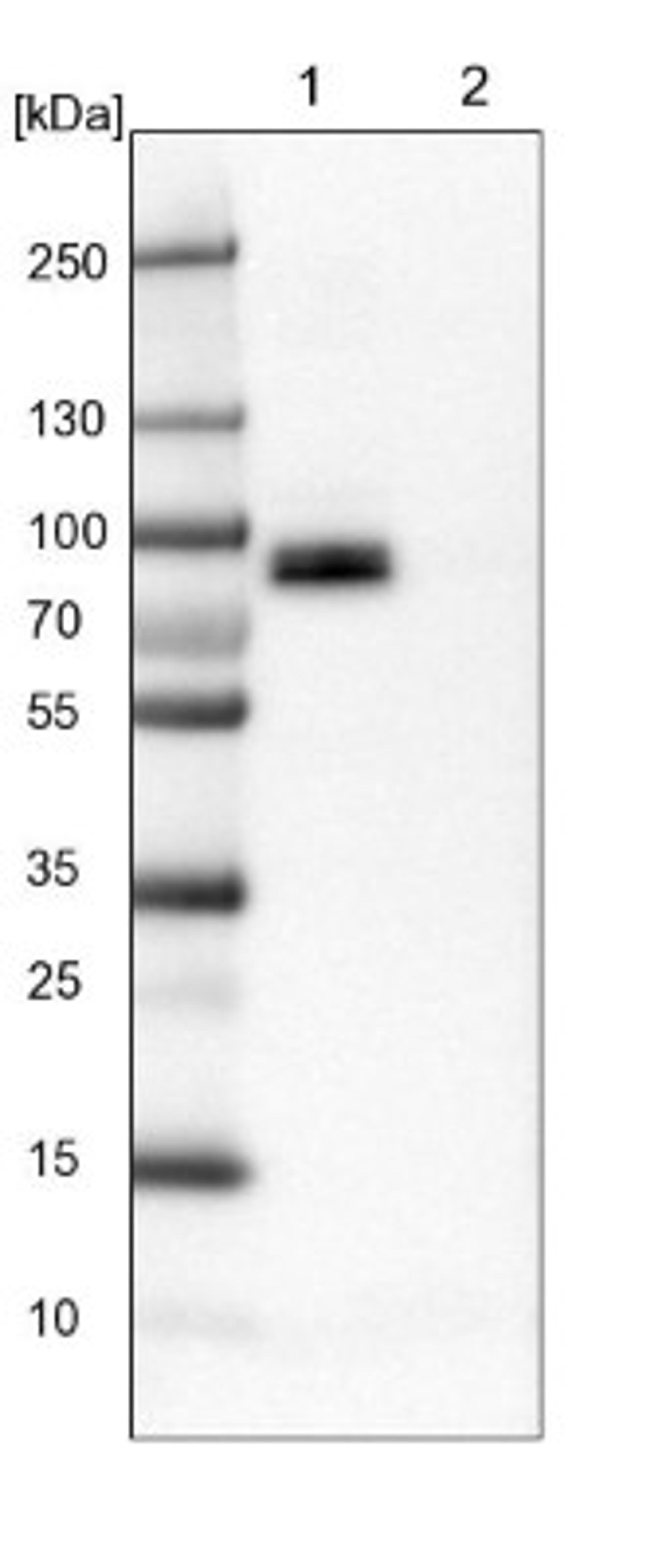 Western Blot: Glycogen synthase 2 Antibody [NBP1-91191] - Lane 1: Mouse liver tissue lysate<br/>Lane 2: Rat liver tissue lysate