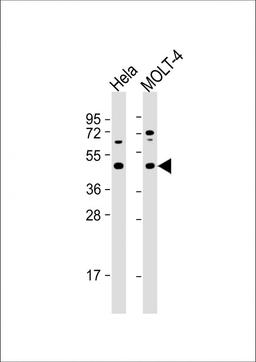 Western Blot at 1:1000 dilution Lane 1: Hela whole cell lysate Lane 2: MOLT-4 whole cell lysate Lysates/proteins at 20 ug per lane.