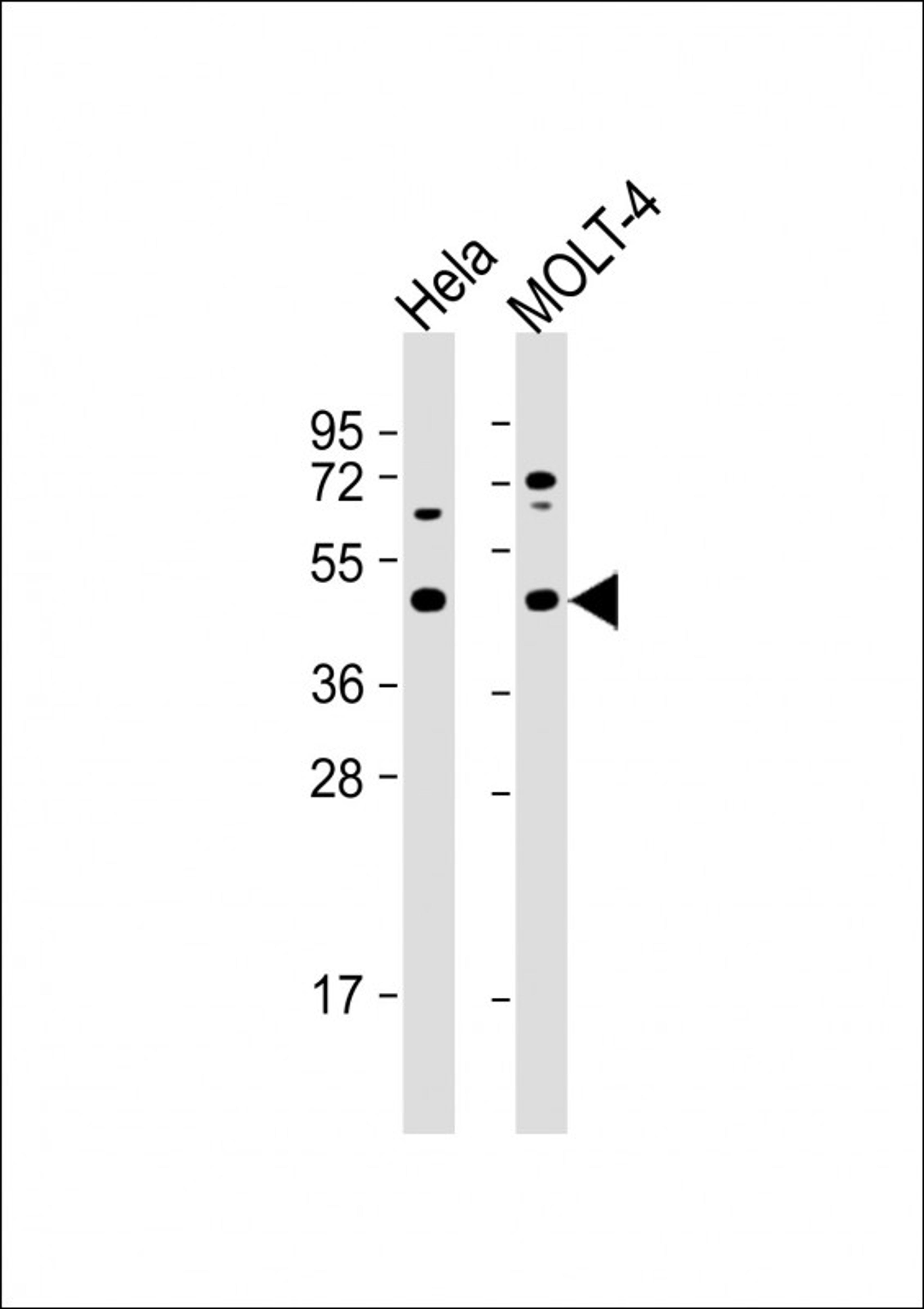 Western Blot at 1:1000 dilution Lane 1: Hela whole cell lysate Lane 2: MOLT-4 whole cell lysate Lysates/proteins at 20 ug per lane.