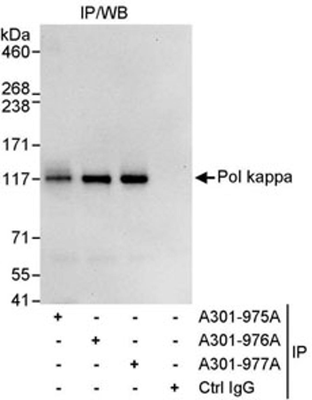 Detection of human Pol kappa by western blot of immunoprecipitates.