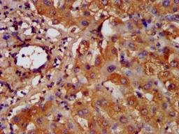 IHC image of CSB-PA010123LA01HU diluted at 1:200 and staining in paraffin-embedded human liver tissue performed on a Leica BondTM system. After dewaxing and hydration, antigen retrieval was mediated by high pressure in a citrate buffer (pH 6.0). Section was blocked with 10% normal goat serum 30min at RT. Then primary antibody (1% BSA) was incubated at 4&deg;C overnight. The primary is detected by a biotinylated secondary antibody and visualized using an HRP conjugated SP system.