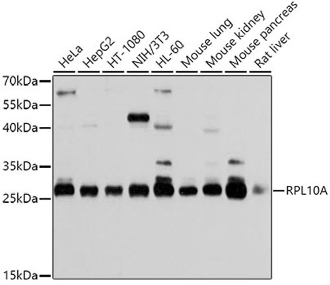 Western blot - RPL10A antibody (A5925)