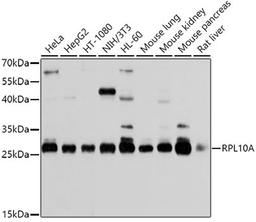 Western blot - RPL10A antibody (A5925)