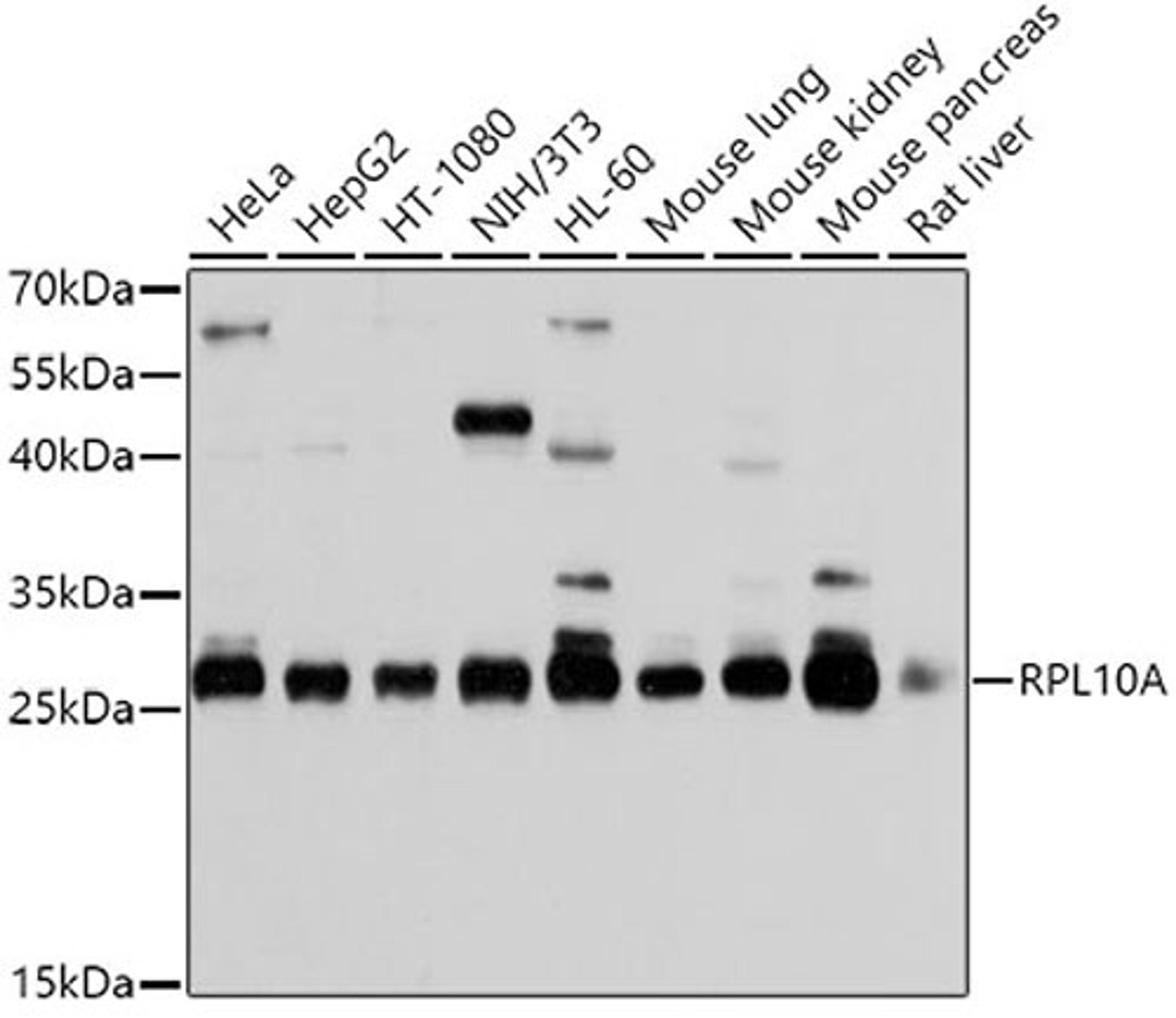 Western blot - RPL10A antibody (A5925)