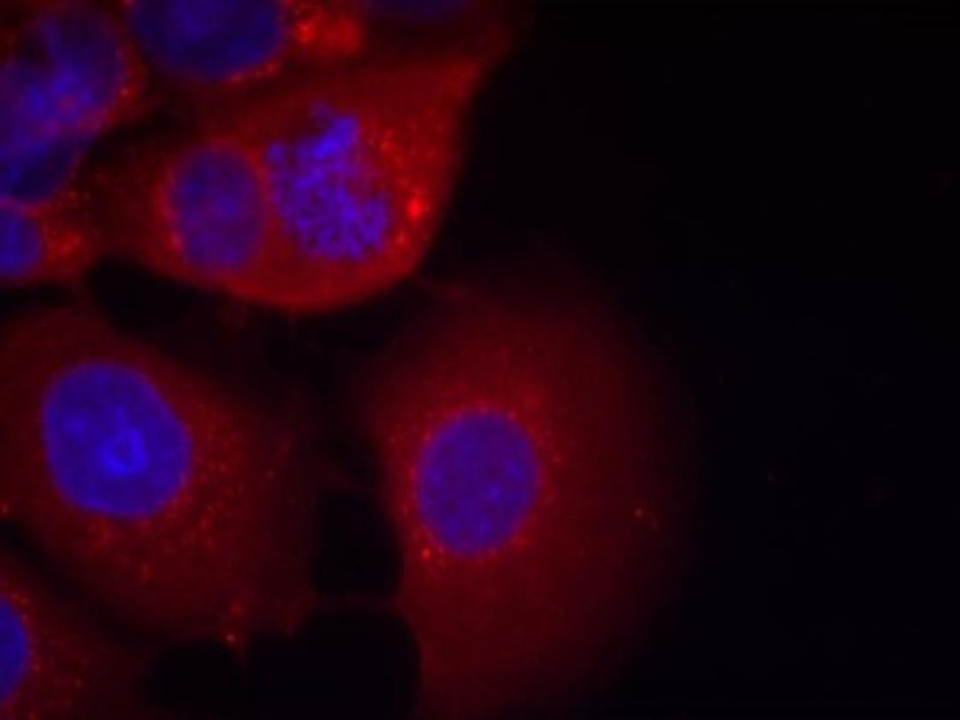 Immunocytochemistry/Immunofluorescence: GSK3 alpha Antibody [NB100-81943] - Staining of methanol-fixed MCF7 cells using GSK3a(Ab-21) antibody