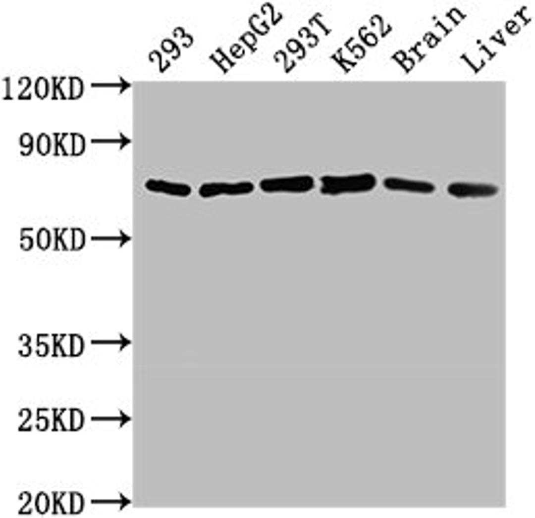 Western Blot. Positive WB detected in: 293 whole cell lysate, HepG2 whole cell lysate, 293T whole cell lysate, K562 whole cell lysate, Mouse brain tissue, Mouse liver tissue. All lanes: HSPD1 antibody at 1:2000. Secondary. Goat polyclonal to rabbit IgG at 1/50000 dilution. Predicted band size: 62, 18 kDa. Observed band size: 62 kDa. 