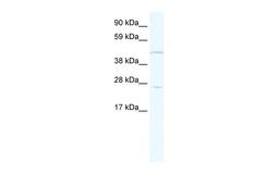 Antibody used in WB on Human Prostate at 1.25 ug/ml.