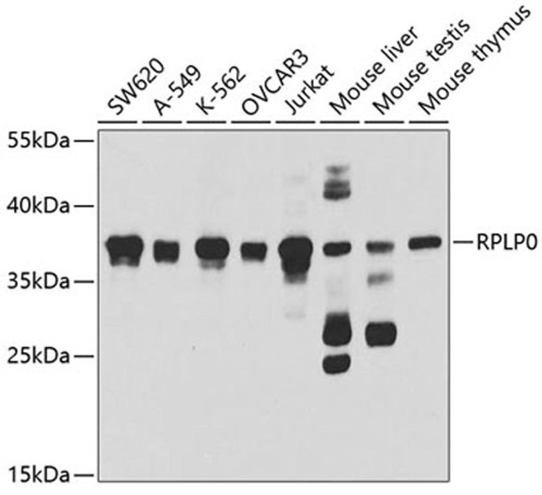 Western blot - RPLP0 antibody (A5557)