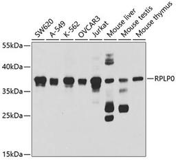 Western blot - RPLP0 antibody (A5557)