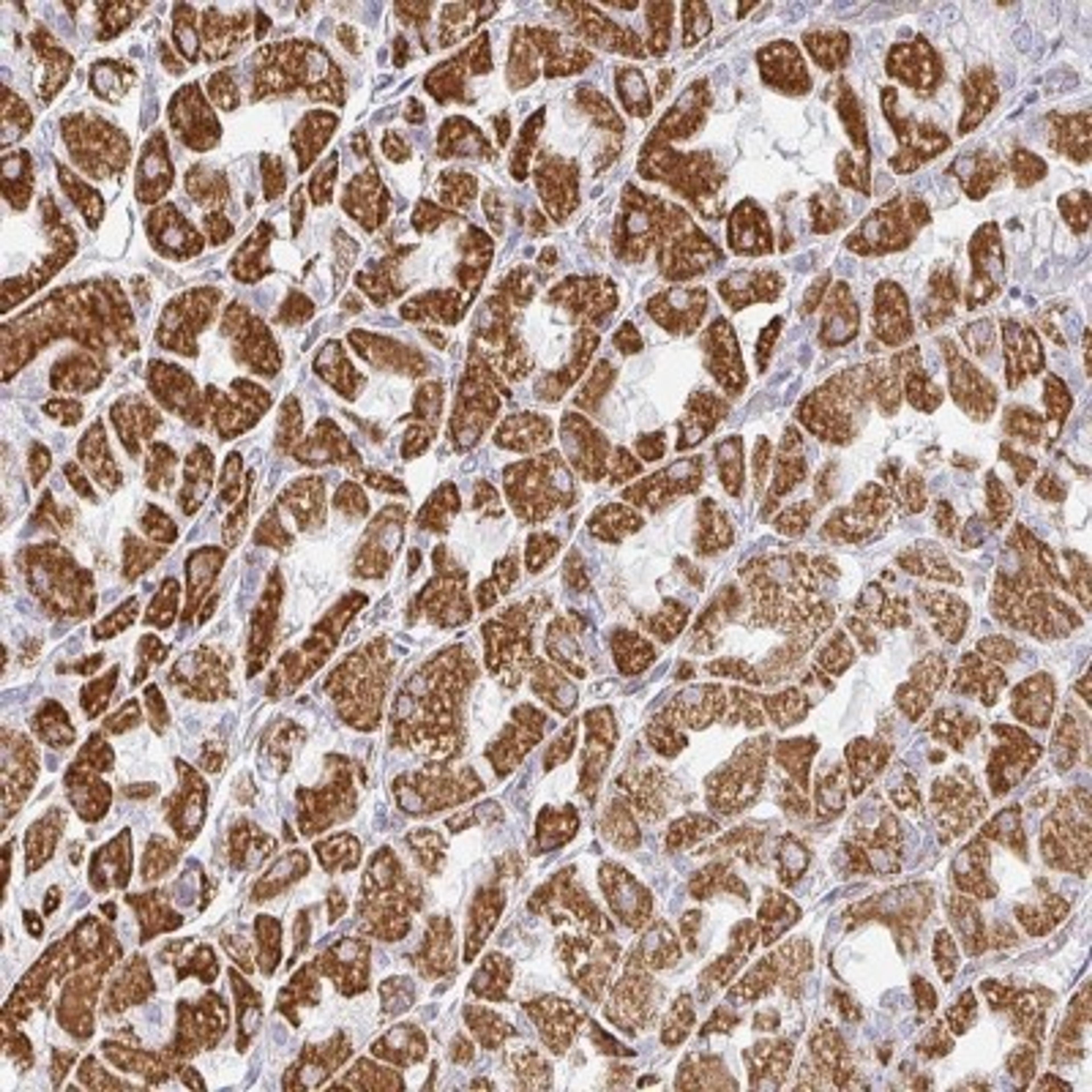 Immunohistochemistry: ZNF526 Antibody [NBP2-31644] - Staining of human stomach, upper shows strong cytoplasmic positivity in glandular cells.