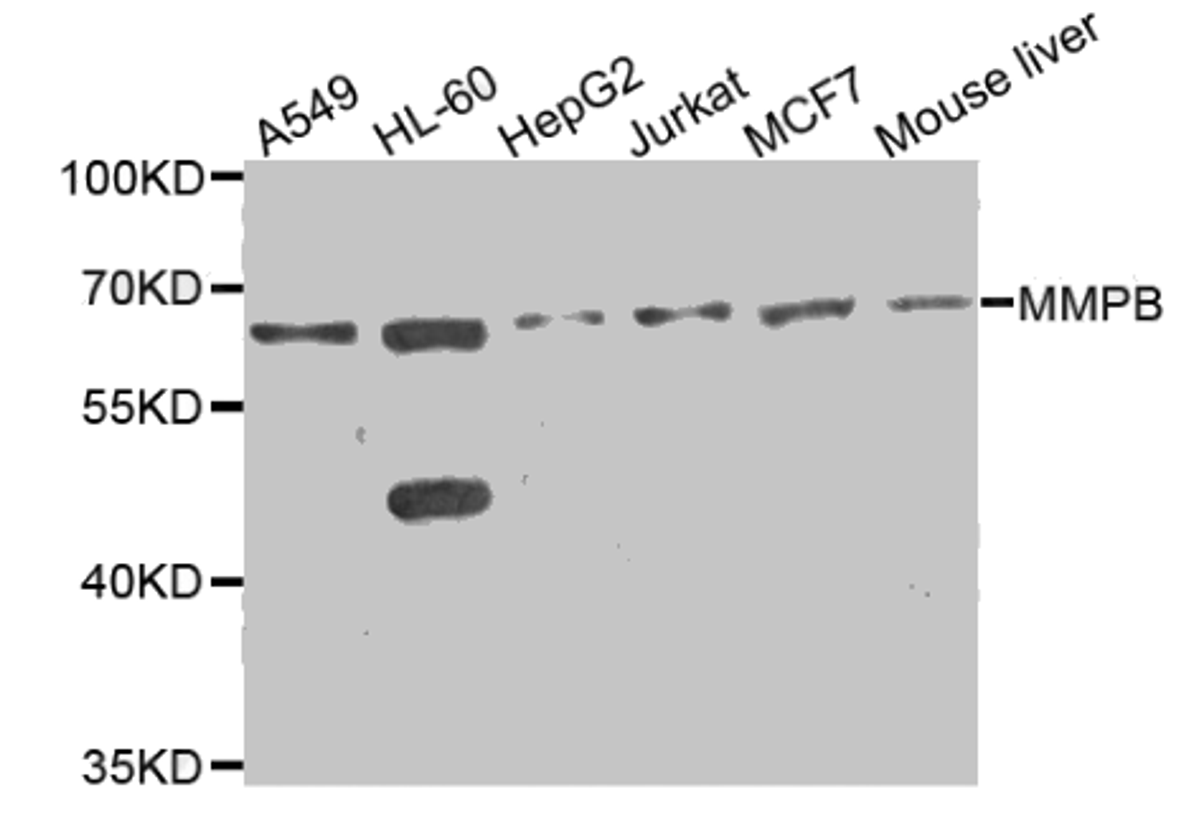 Western blot analysis of extracts of various cell lines, using MMP8 antibody