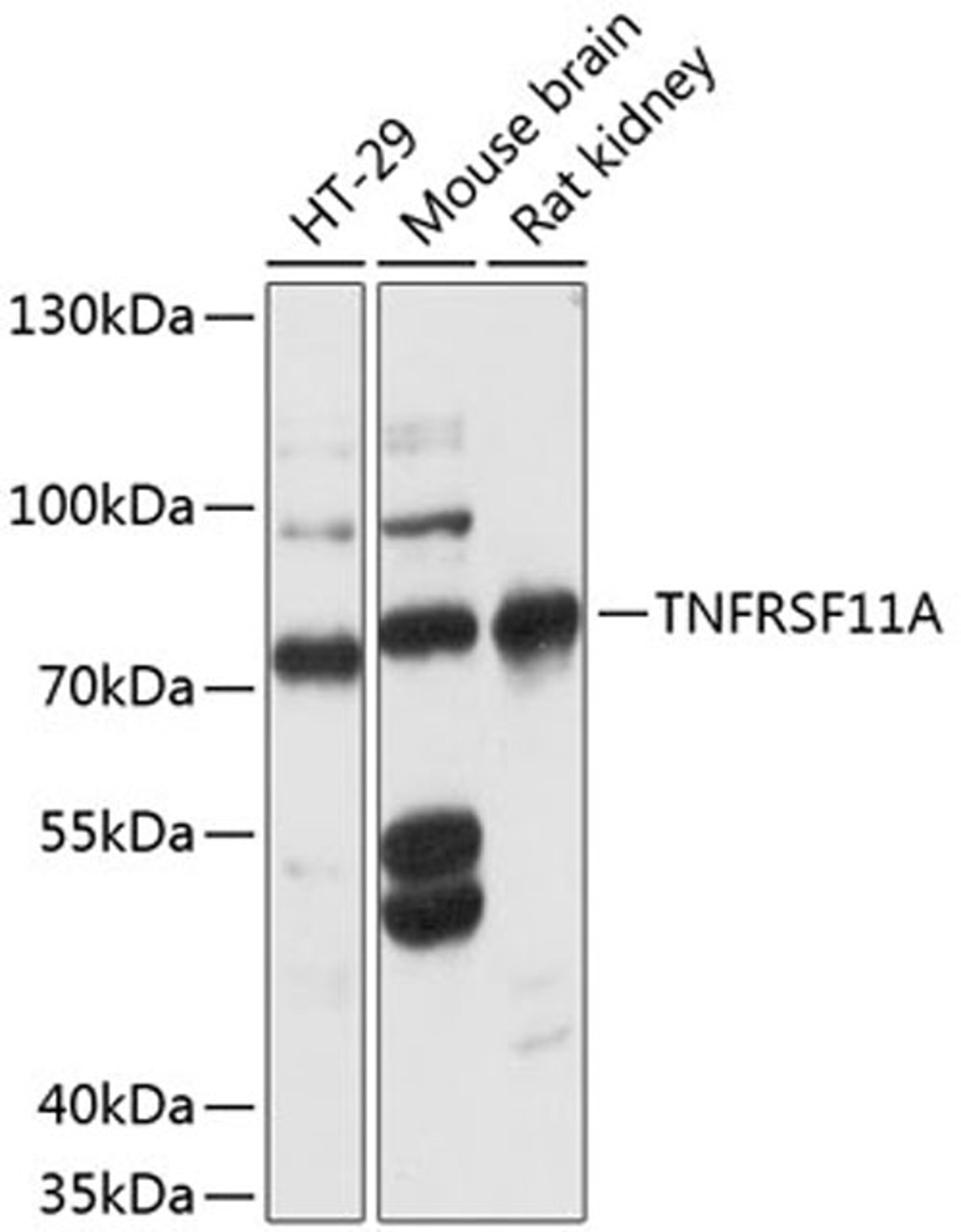 Western blot - TNFRSF11A antibody (A12997)