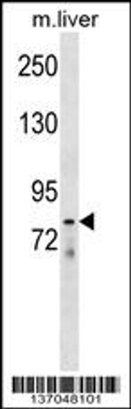 Western blot analysis in mouse liver tissue lysates (35ug/lane).