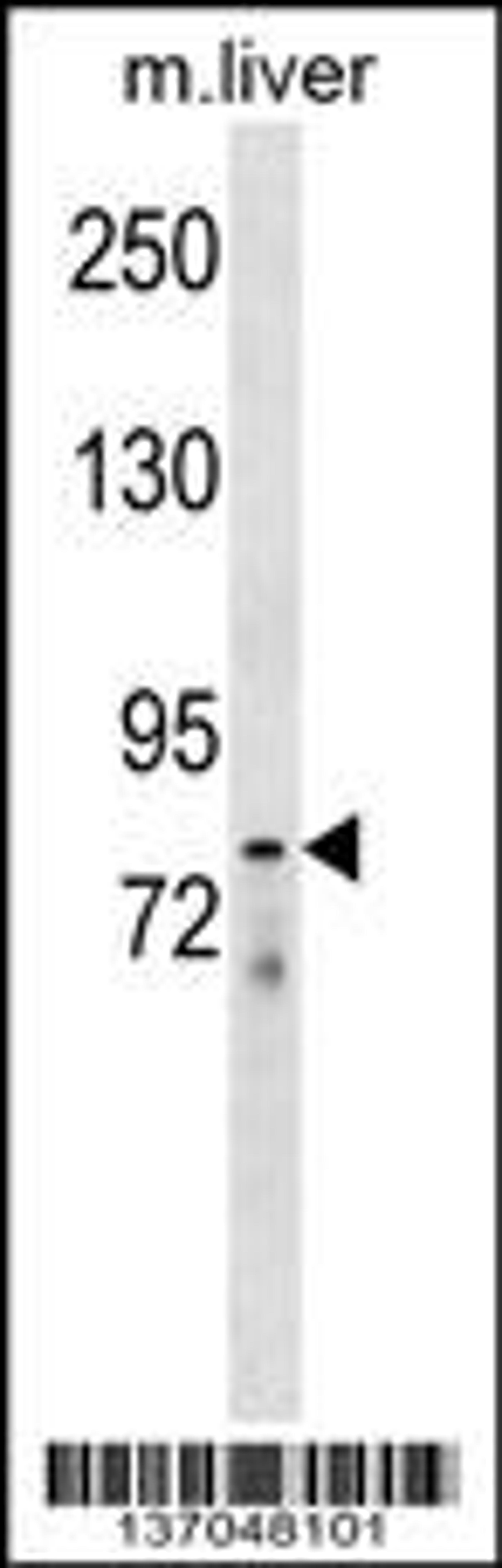 Western blot analysis in mouse liver tissue lysates (35ug/lane).