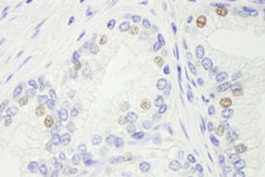 Detection of human GTF2IRD/TFII-IRD1 by immunohistochemistry.