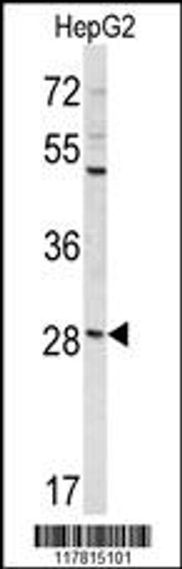 Western blot analysis of DIPA Antibody in HepG2 cell line lysates (35ug/lane)