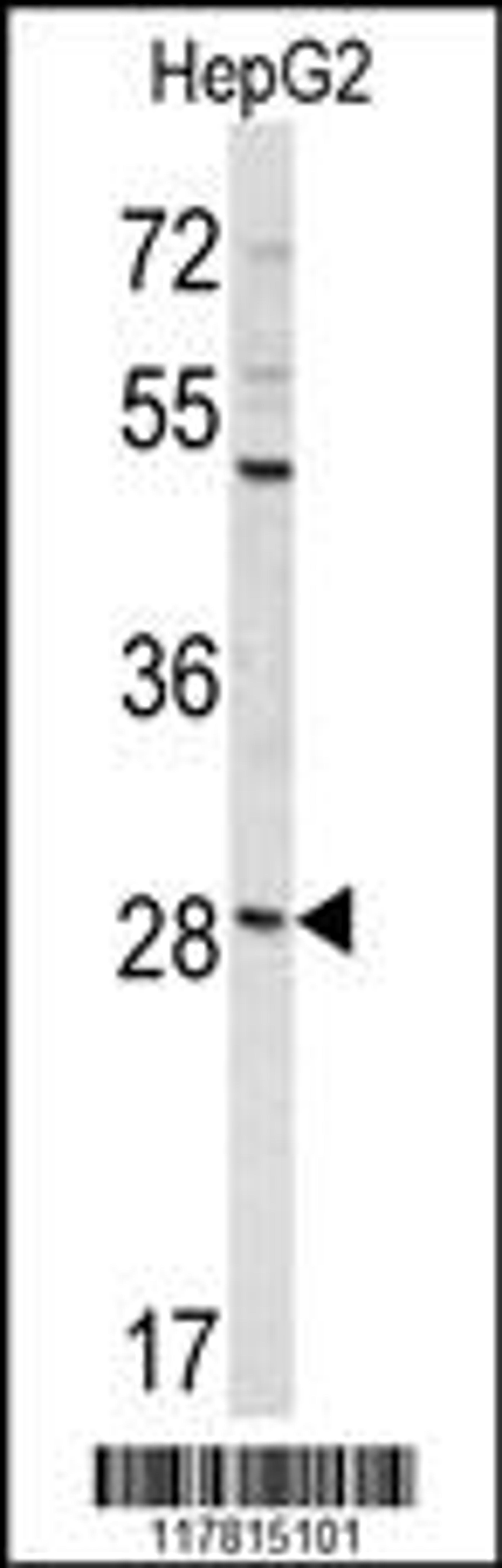 Western blot analysis of DIPA Antibody in HepG2 cell line lysates (35ug/lane)