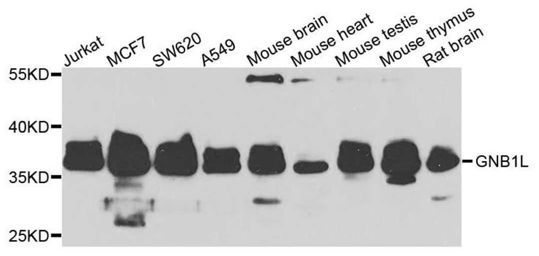 Western blot analysis of extracts of various cells using GNB1L antibody