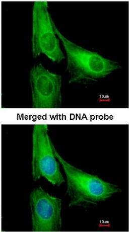 Immunocytochemistry/Immunofluorescence: AGAP1 Antibody [NBP1-31261] - Analysis of HeLa, using AGAP1 antibody at 1:200 dilution.