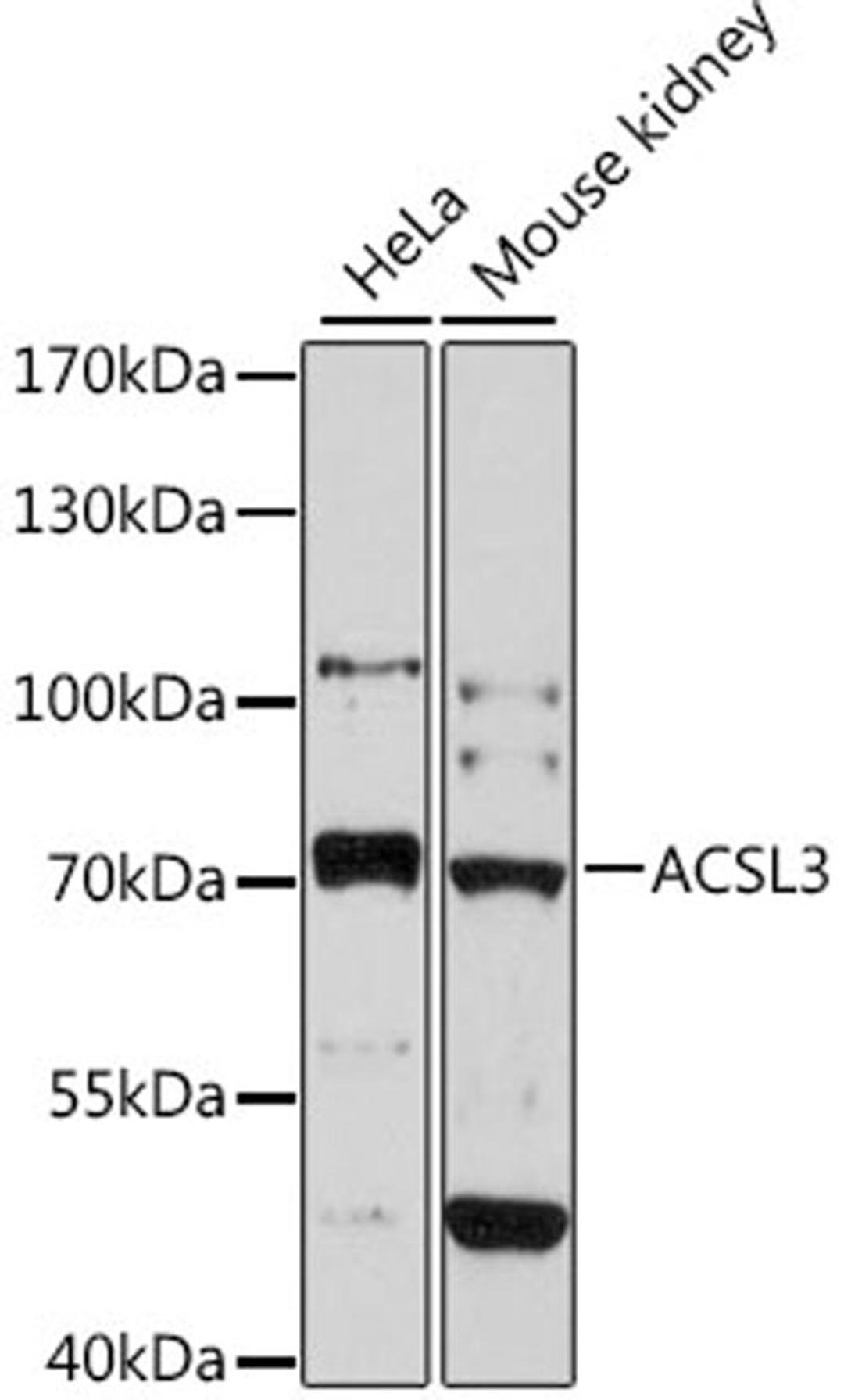 Western blot - ACSL3 antibody (A11679)