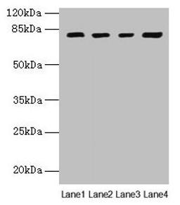 Western blot. All lanes: DHX35 antibody at 12µg/ml. Lane 1: Mouse kidney tissue. Lane 2: Mouse liver tissue. Lane 3: K562 whole cell lysate. Lane 4: Hela whole cell lysate. Secondary. Goat polyclonal to rabbit IgG at 1/10000 dilution. Predicted band size: 79, 76 kDa. Observed band size: 79 kDa