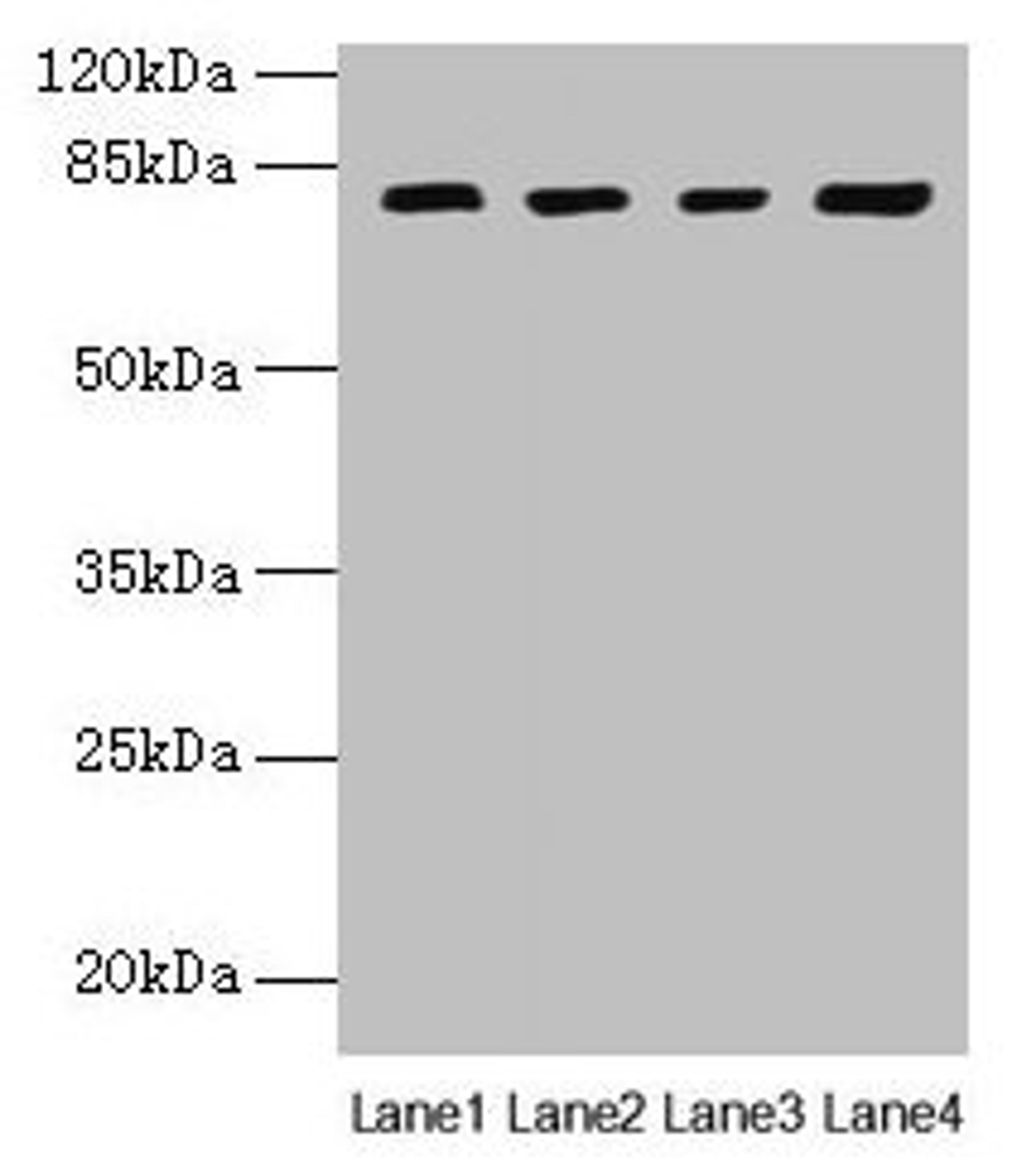 Western blot. All lanes: DHX35 antibody at 12µg/ml. Lane 1: Mouse kidney tissue. Lane 2: Mouse liver tissue. Lane 3: K562 whole cell lysate. Lane 4: Hela whole cell lysate. Secondary. Goat polyclonal to rabbit IgG at 1/10000 dilution. Predicted band size: 79, 76 kDa. Observed band size: 79 kDa