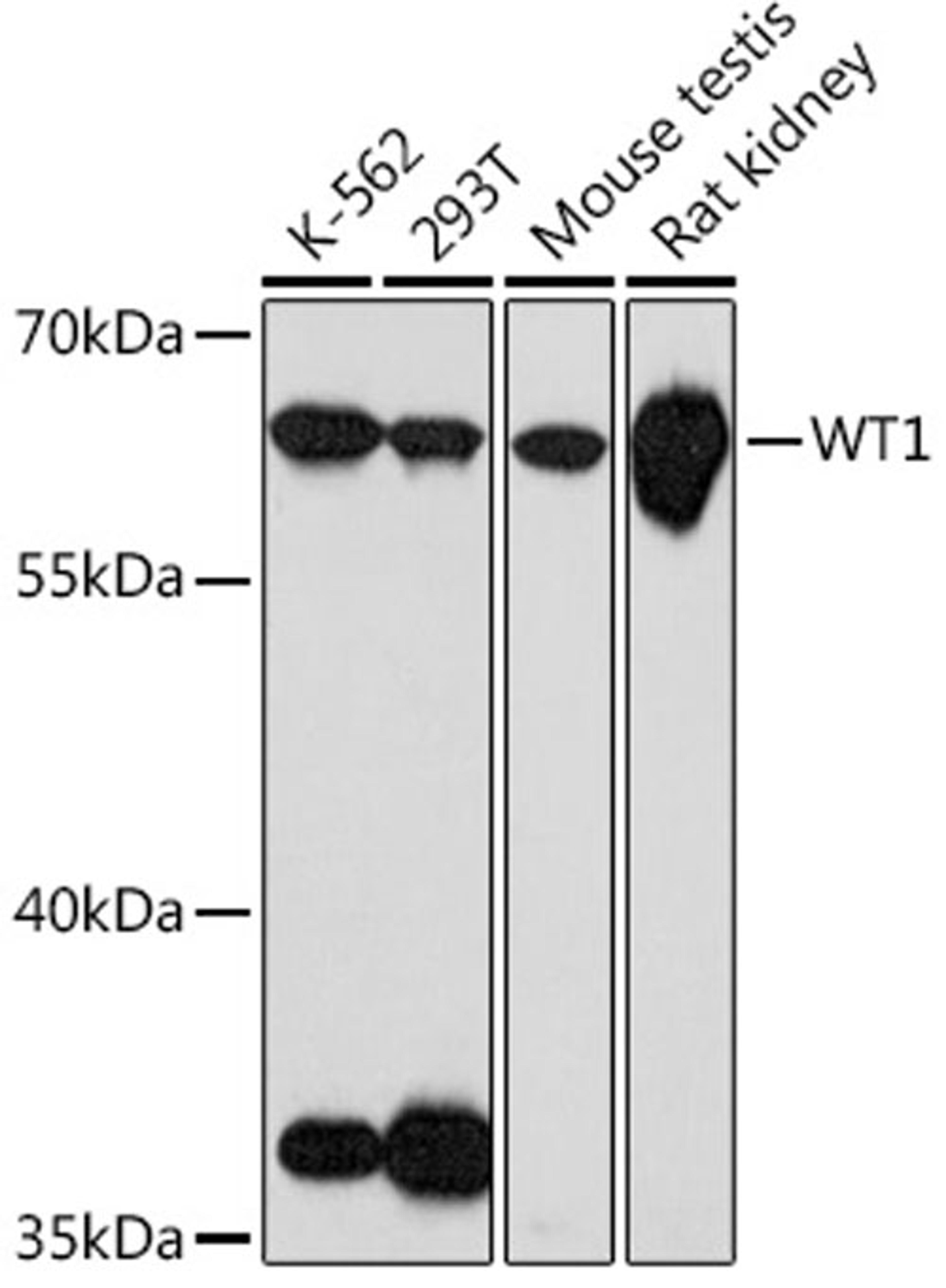 Western blot - WT1 Rabbit pAb (A17006)