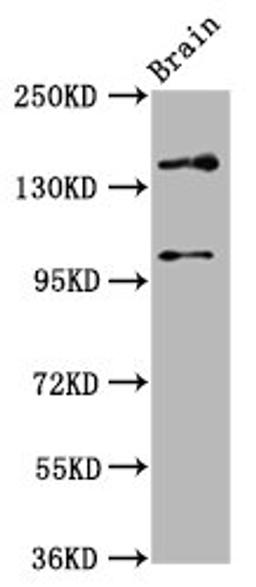 Western Blot. Positive WB detected in: Rat brain tissue. All lanes: SOS1 antibody at 4.6ug/ml. Secondary. Goat polyclonal to rabbit IgG at 1/50000 dilution. Predicted band size: 153, 37 kDa. Observed band size: 153 kDa.