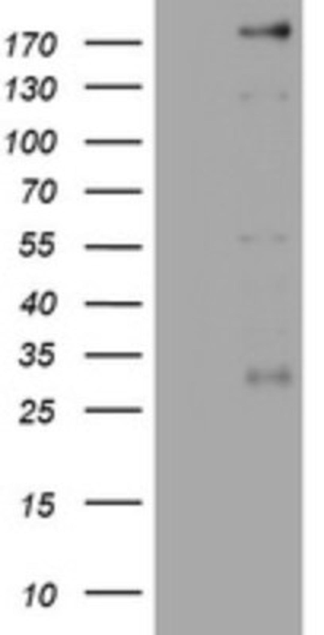 Western Blot: PEG3 Antibody (1E10) [NBP2-46379] - Analysis of HEK293T cells were transfected with the pCMV6-ENTRY control (Left lane) or pCMV6-ENTRY PEG3.