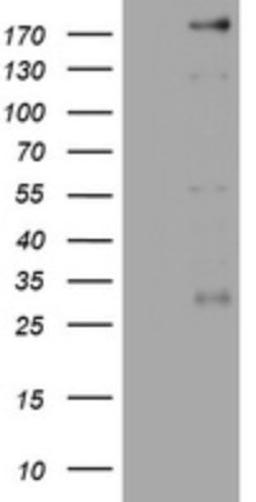 Western Blot: PEG3 Antibody (1E10) [NBP2-46379] - Analysis of HEK293T cells were transfected with the pCMV6-ENTRY control (Left lane) or pCMV6-ENTRY PEG3.