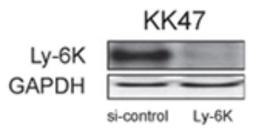 Immunohistochemistry-Paraffin: Ly-6K Antibody [NBP2-24405] - Western blot analysis of Ly-6K in KK47 human bladder carcinoma cells using NBP2-24405. LY-6K siRNA, but not scrambled siRNA knocked down Ly-6K expression. A GAPDH antibody was used as a protein loading control. Data courtesy of Masuda et al.