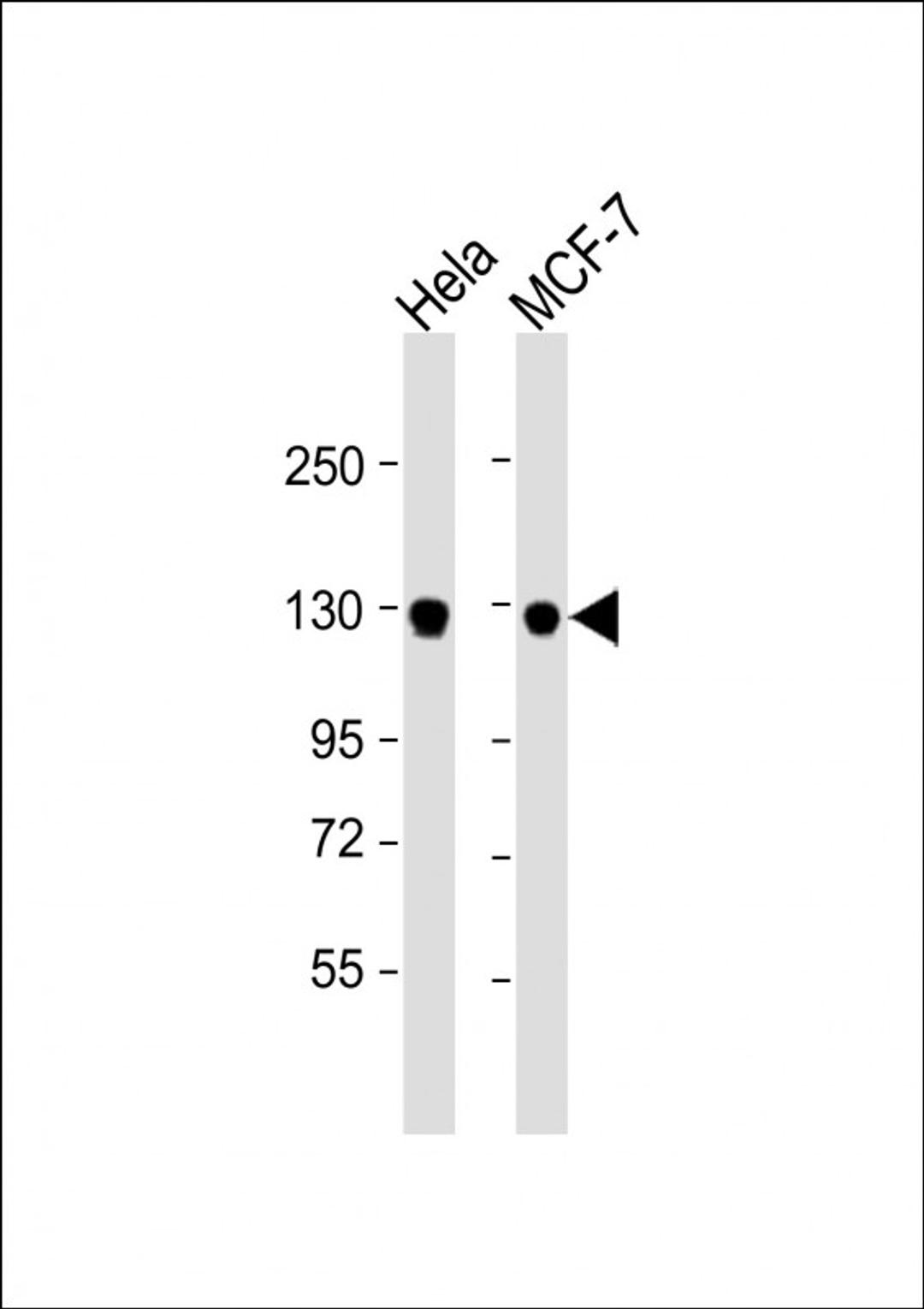 Western Blot at 1:1000 dilution Lane 1: Hela whole cell lysate Lane 2: MCF-7 whole cell lysate Lysates/proteins at 20 ug per lane.