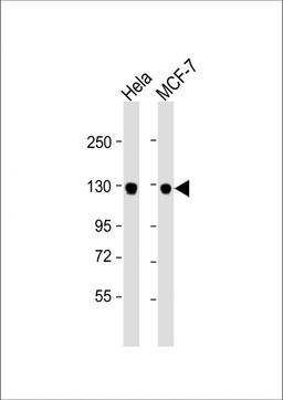 Western Blot at 1:1000 dilution Lane 1: Hela whole cell lysate Lane 2: MCF-7 whole cell lysate Lysates/proteins at 20 ug per lane.