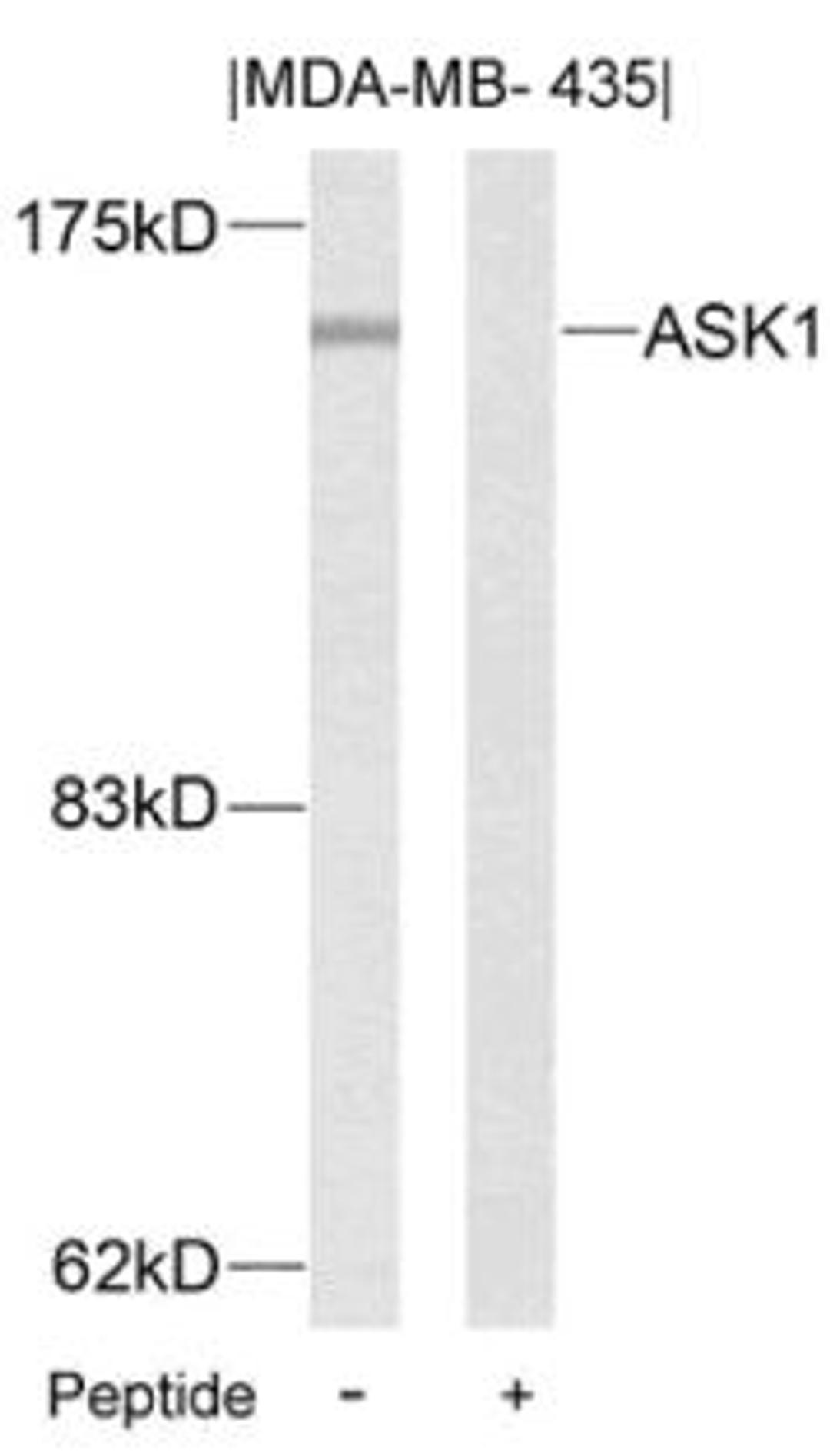 Western blot analysis of lysed extracts from MDA-MB- 435 cells using ASK1 (Ab-83).