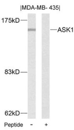 Western blot analysis of lysed extracts from MDA-MB- 435 cells using ASK1 (Ab-83).