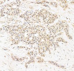 Detection of human CAP-H2 by immunohistochemistry.