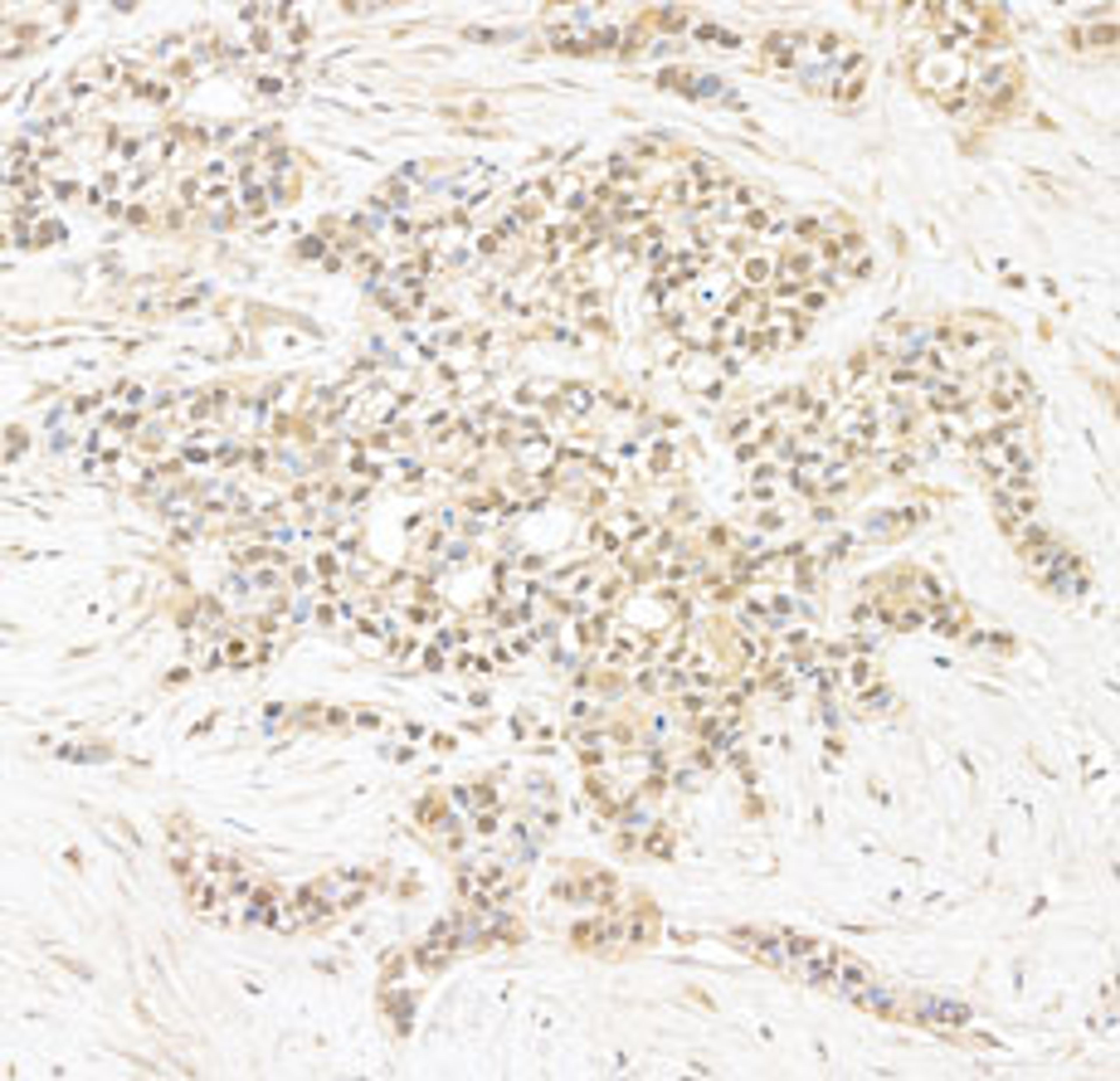 Detection of human CAP-H2 by immunohistochemistry.