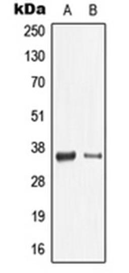 Western blot analysis of THP1 (Lane 1), mouse spleen (Lane 2) whole cell lysates using LGALS9 antibody