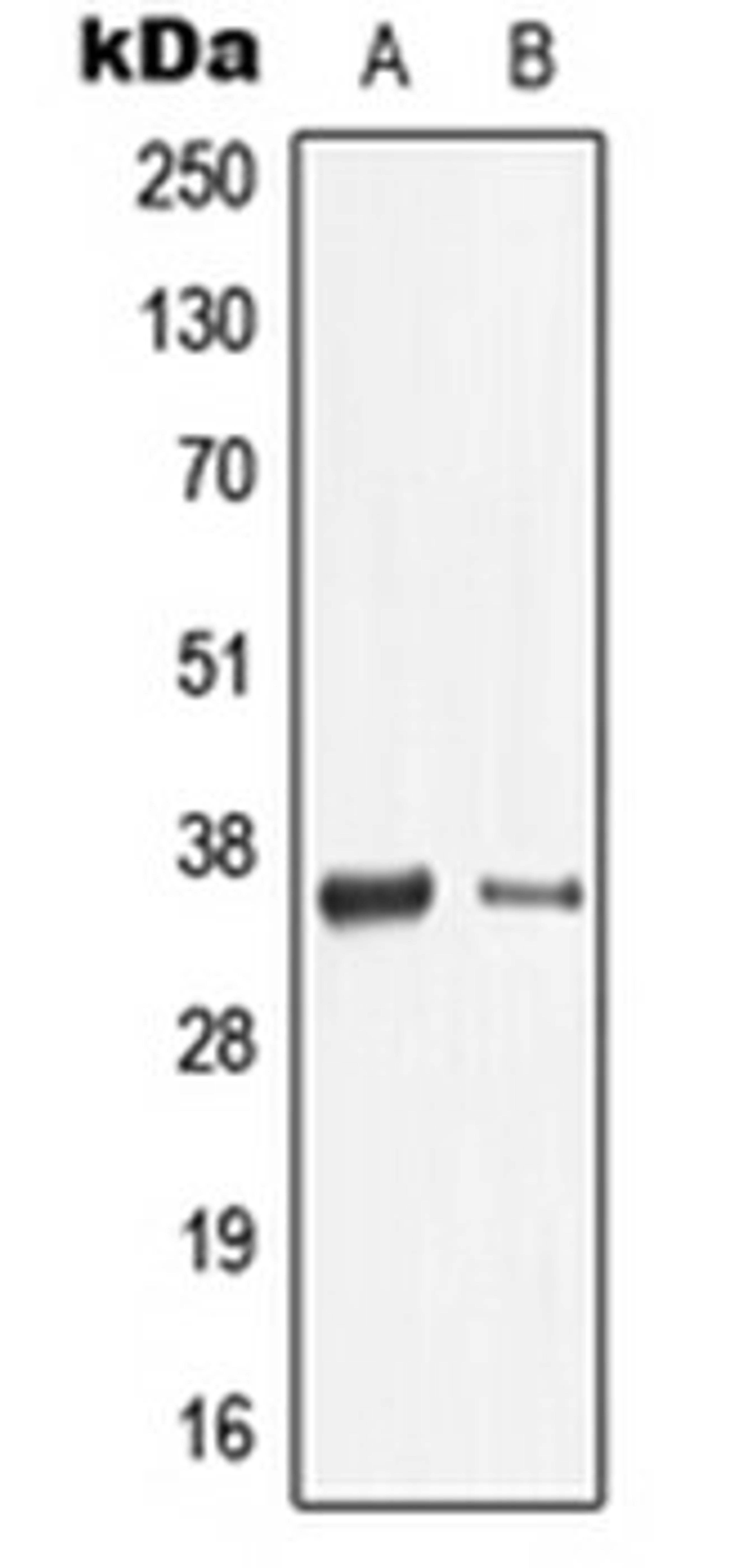 Western blot analysis of THP1 (Lane 1), mouse spleen (Lane 2) whole cell lysates using LGALS9 antibody