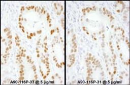 Detection of human p53 by immunoperoxidase.