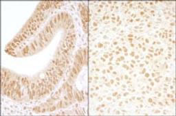 Detection of human and mouse CKII beta by immunohistochemistry.