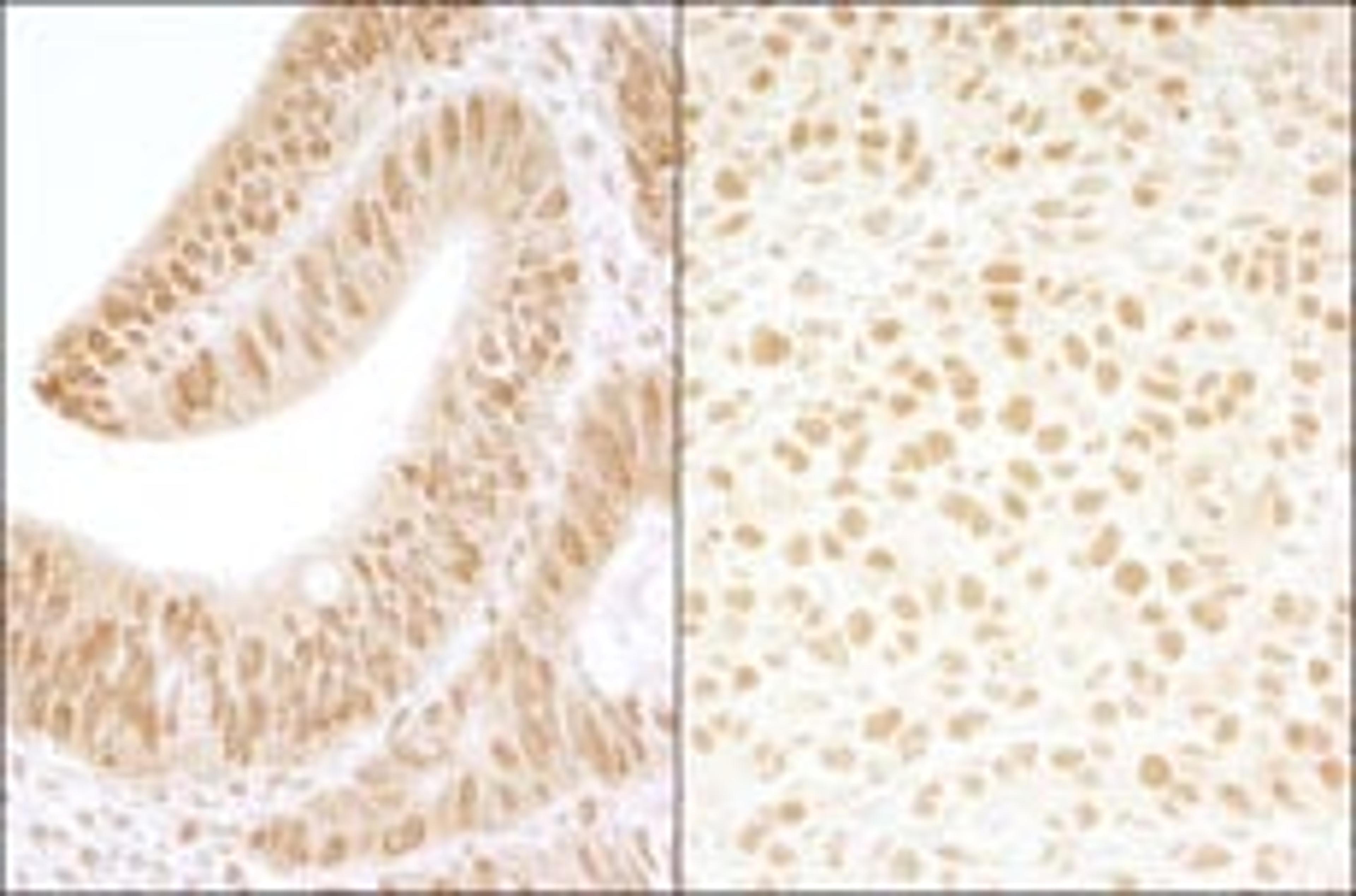 Detection of human and mouse CKII beta by immunohistochemistry.