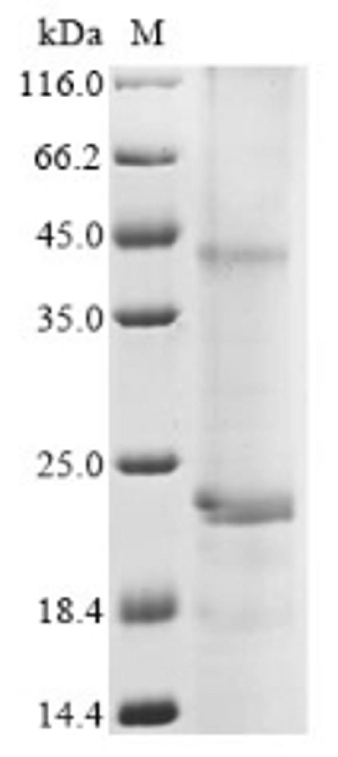 (Tris-Glycine gel) Discontinuous SDS-PAGE (reduced) with 5% enrichment gel and 15% separation gel.