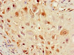 Immunohistochemistry of paraffin-embedded human placenta tissue using CSB-PA007932LA01HU at dilution of 1:100