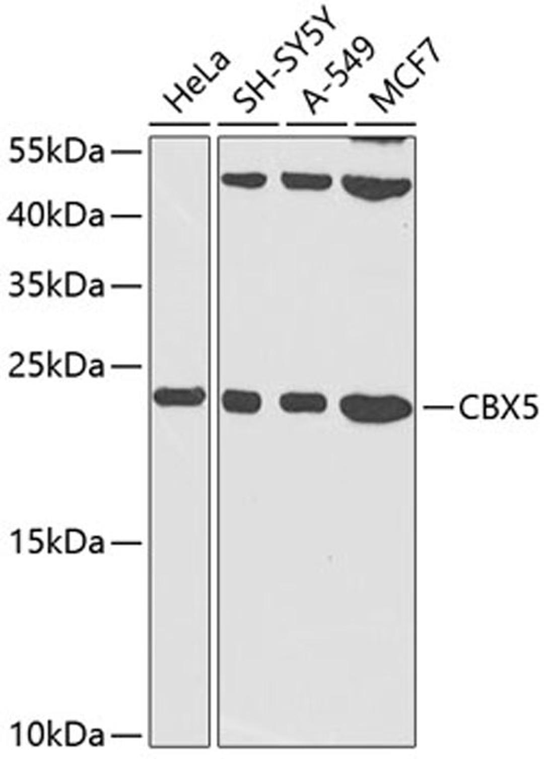 Western blot - CBX5 antibody (A12592)