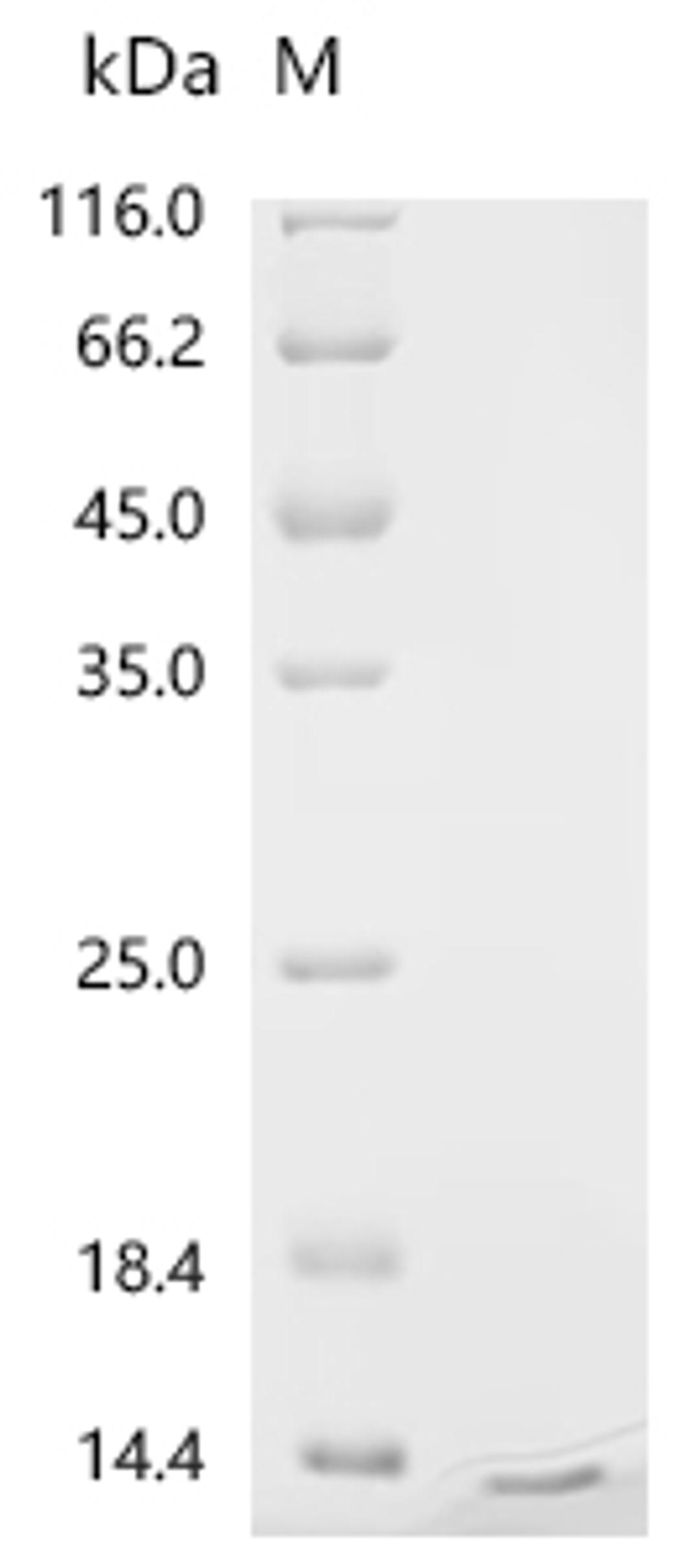 (Tris-Glycine gel) Discontinuous SDS-PAGE (reduced) with 5% enrichment gel and 15% separation gel.