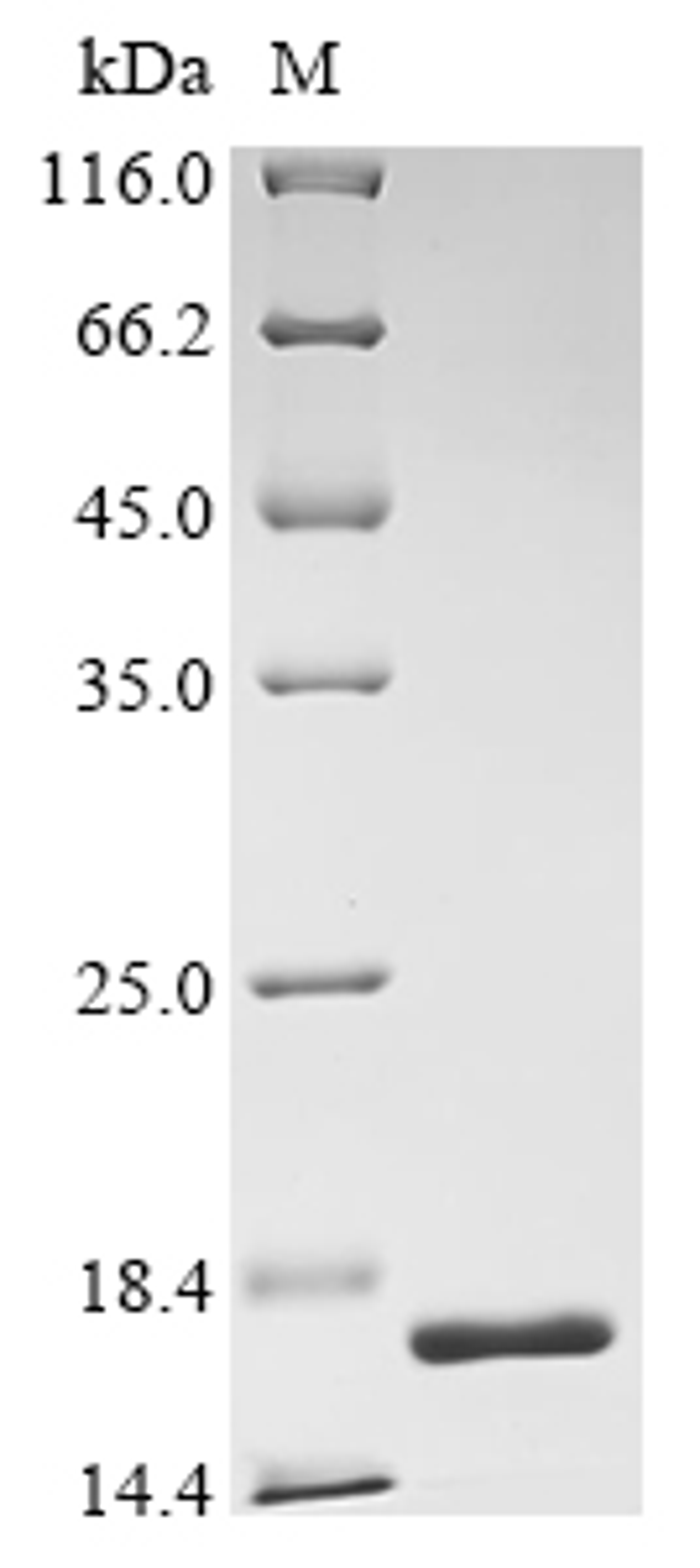 (Tris-Glycine gel) Discontinuous SDS-PAGE (reduced) with 5% enrichment gel and 15% separation gel.